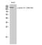 EPH Receptor A2 antibody, STJ90710, St John