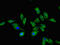 Cathepsin A antibody, LS-C396275, Lifespan Biosciences, Immunofluorescence image 