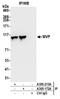 Major Vault Protein antibody, A305-172A, Bethyl Labs, Immunoprecipitation image 