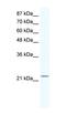 Regulator Of G Protein Signaling 10 antibody, orb331570, Biorbyt, Western Blot image 