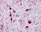 Crystallin Alpha B antibody, GTX13497, GeneTex, Immunohistochemistry frozen image 