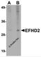 EF-Hand Domain Family Member D2 antibody, 5657, ProSci, Western Blot image 