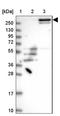 Family With Sequence Similarity 186 Member A antibody, NBP1-93553, Novus Biologicals, Western Blot image 