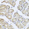 Cell Division Cycle 45 antibody, 18-465, ProSci, Immunohistochemistry paraffin image 