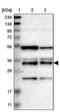 Translocase Of Outer Mitochondrial Membrane 34 antibody, PA5-53862, Invitrogen Antibodies, Western Blot image 