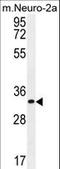 Zinc Finger CCCH-Type Containing 8 antibody, LS-C160740, Lifespan Biosciences, Western Blot image 