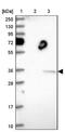 THAP Domain Containing 11 antibody, NBP1-92495, Novus Biologicals, Western Blot image 