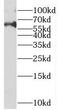 Methyltransferase Like 16 antibody, FNab05136, FineTest, Western Blot image 