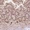 TBC1 Domain Family Member 17 antibody, NBP2-49546, Novus Biologicals, Immunohistochemistry paraffin image 