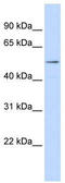 Lysine Methyltransferase 5B antibody, TA335572, Origene, Western Blot image 