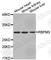 RNA Binding Protein, MRNA Processing Factor antibody, A4478, ABclonal Technology, Western Blot image 