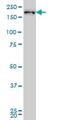 Cyclin Dependent Kinase 12 antibody, ab57311, Abcam, Western Blot image 