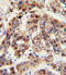 Ornithine Carbamoyltransferase antibody, LS-C163283, Lifespan Biosciences, Immunohistochemistry frozen image 