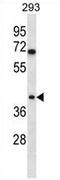 Torsin Family 1 Member B antibody, AP54336PU-N, Origene, Western Blot image 