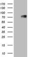 Thyroid Hormone Receptor Alpha antibody, TA805188, Origene, Western Blot image 