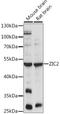 Zic Family Member 2 antibody, A15736, ABclonal Technology, Western Blot image 