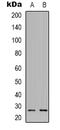 Neurexophilin 3 antibody, abx133519, Abbexa, Western Blot image 