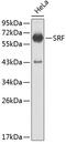 Serum Response Factor antibody, 13-166, ProSci, Western Blot image 