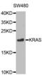 KRAS Proto-Oncogene, GTPase antibody, abx001104, Abbexa, Western Blot image 