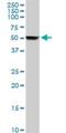 Cytochrome P450 Family 2 Subfamily A Member 6 antibody, H00001548-D01P, Novus Biologicals, Western Blot image 