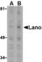 Leucine Rich Repeat Containing 1 antibody, TA306094, Origene, Western Blot image 