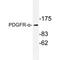 Platelet Derived Growth Factor Receptor Alpha antibody, AP20262PU-N, Origene, Western Blot image 