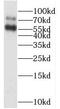 Rap Guanine Nucleotide Exchange Factor Like 1 antibody, FNab07116, FineTest, Western Blot image 