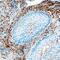 FAP antibody, AF3715, R&D Systems, Immunohistochemistry paraffin image 