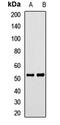 Calcitonin Receptor Like Receptor antibody, LS-C667725, Lifespan Biosciences, Western Blot image 