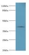 Serpin Family B Member 8 antibody, LS-C370318, Lifespan Biosciences, Western Blot image 