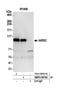 Isoleucyl-TRNA Synthetase 2, Mitochondrial antibody, NBP2-59104, Novus Biologicals, Western Blot image 
