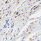 Mitogen-Activated Protein Kinase 13 antibody, 18-649, ProSci, Immunohistochemistry paraffin image 