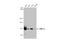 DNA Methyltransferase 3 Alpha antibody, GTX129125, GeneTex, Western Blot image 