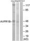 Arginine Vasopressin Receptor 1B antibody, LS-C120968, Lifespan Biosciences, Western Blot image 