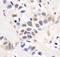 Partner And Localizer Of BRCA2 antibody, NB100-60439, Novus Biologicals, Immunohistochemistry frozen image 