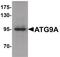 mATG9 antibody, PA5-21043, Invitrogen Antibodies, Western Blot image 