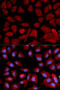 Proteasome 26S Subunit, ATPase 4 antibody, 18-674, ProSci, Immunofluorescence image 