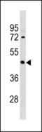 Iroquois Homeobox 1 antibody, LS-C203856, Lifespan Biosciences, Western Blot image 