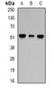 Protein Phosphatase 2 Regulatory Subunit Balpha antibody, orb340831, Biorbyt, Western Blot image 