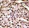 Autophagy Related 9A antibody, LS-C156622, Lifespan Biosciences, Immunohistochemistry paraffin image 