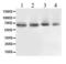 ATP Binding Cassette Subfamily B Member 10 antibody, LS-C662439, Lifespan Biosciences, Western Blot image 