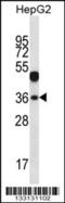 WD Repeat Domain 45B antibody, 56-953, ProSci, Western Blot image 