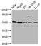 Dymeclin antibody, CSB-PA007291LA01HU, Cusabio, Western Blot image 