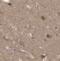 Monoamine Oxidase B antibody, FNab04973, FineTest, Immunohistochemistry paraffin image 
