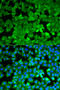 Asparagine Synthetase (Glutamine-Hydrolyzing) antibody, 19-731, ProSci, Immunofluorescence image 