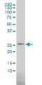 Phosphoserine Phosphatase antibody, H00005723-M02, Novus Biologicals, Western Blot image 