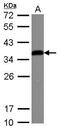 Insulin Like Growth Factor Binding Protein 3 antibody, PA5-27190, Invitrogen Antibodies, Western Blot image 