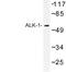 Activin A Receptor Like Type 1 antibody, LS-C177059, Lifespan Biosciences, Western Blot image 