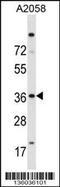 Insulin gene enhancer protein ISL-2 antibody, TA324600, Origene, Western Blot image 