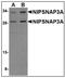 Nipsnap Homolog 3A antibody, AP23003PU-N, Origene, Western Blot image 